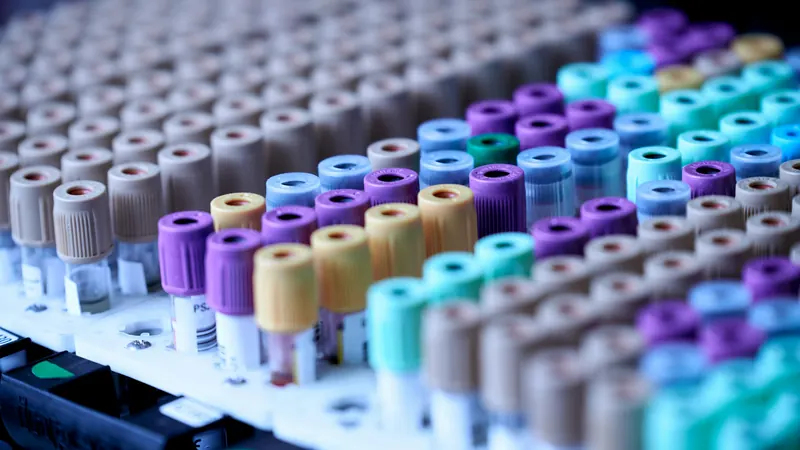 Rows of laboratory sample tubes topped with colourful plastic caps